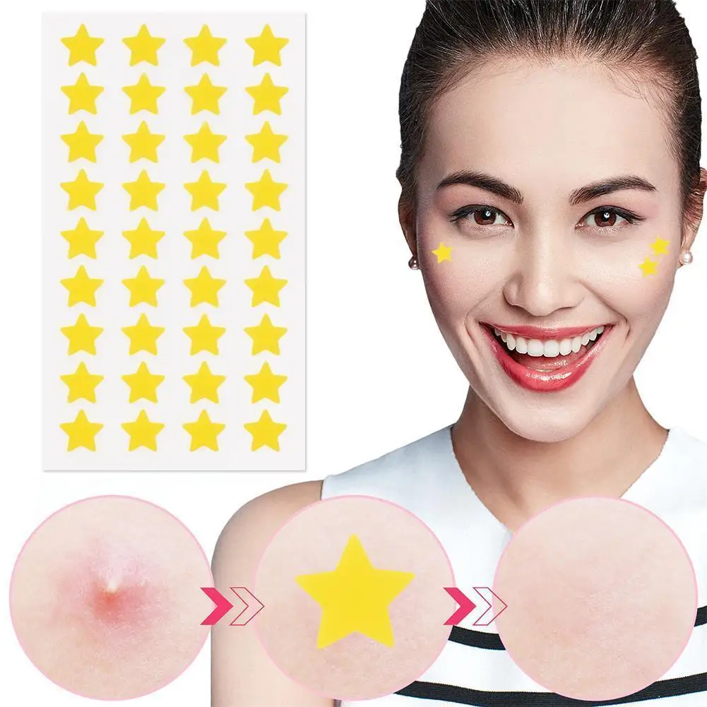 Star Acne/Pimple Patch, Yellow Star Shaped Acne Absorbing Cover Patch, Invisible Hydrocolloid For Face Acne Dots