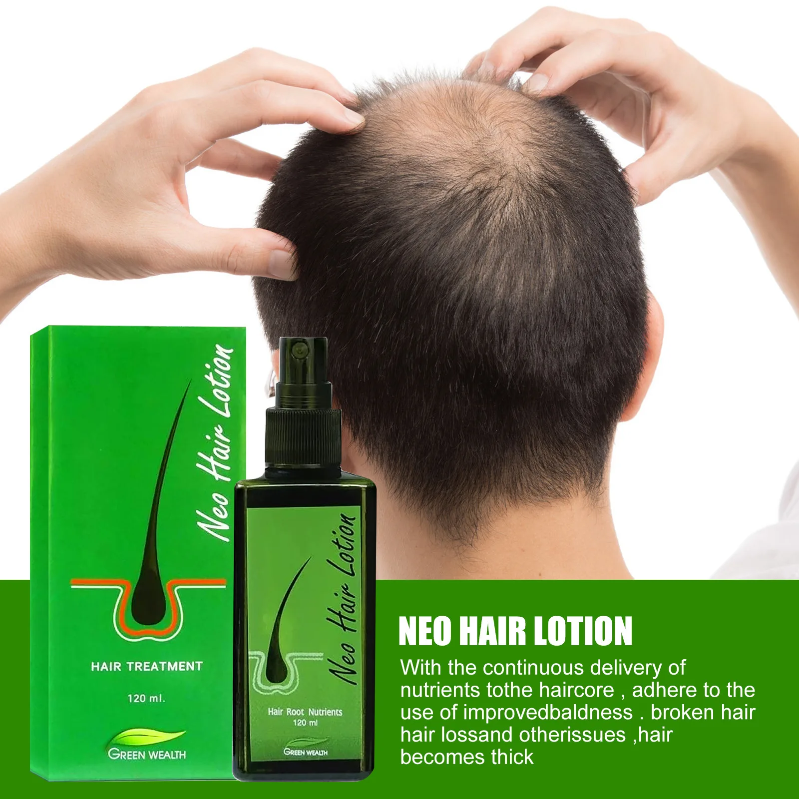 120ml Neo-loción para el cabello para mujeres y hombres, pulverizadores para el crecimiento rápido del cabello, New Hair Lotion