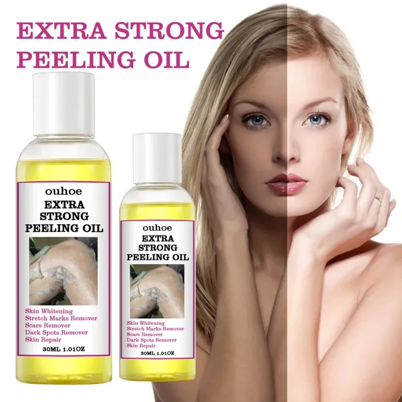 

Yellow Peeling Oil Dark Skin Bleaching Remove Arm elbow Knee Legs Melanin Body Brighten Exfoliating Dead Skin Care Whiten Serum