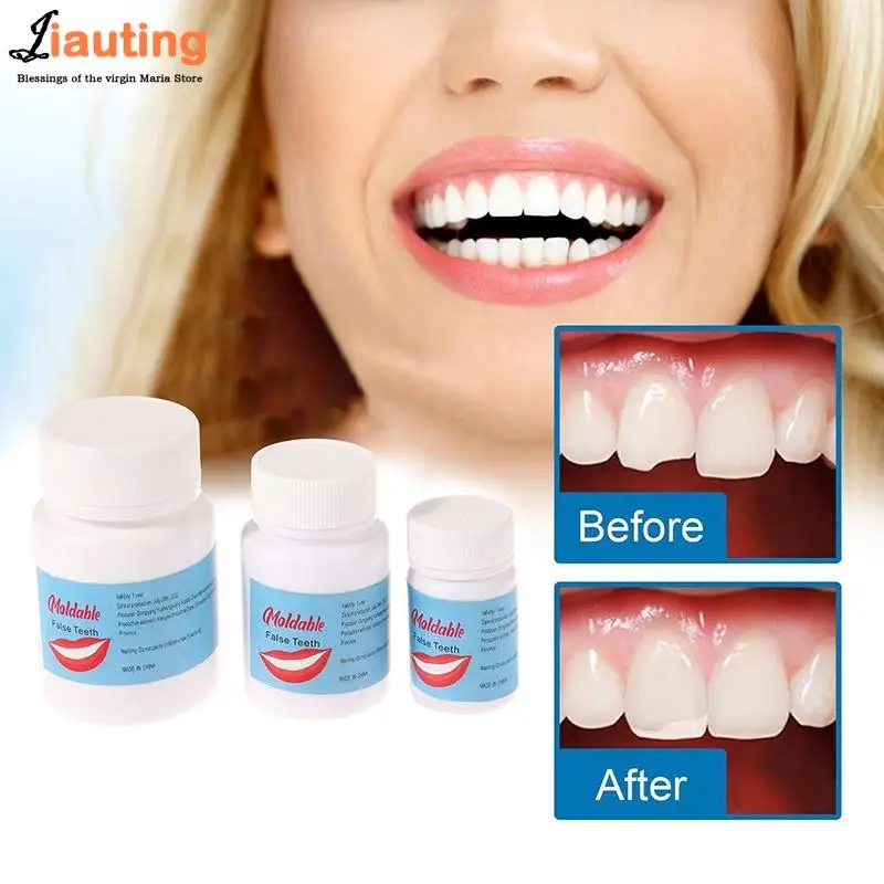 5/10/15/30ml Resin Tooth Repair Glue Shapeable Teeth Gap Filling Solid Glue Temporary Teeth Repair Falseteeth Glue Dental Supply