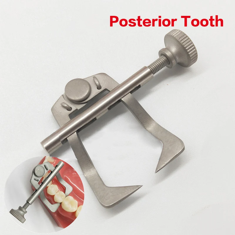 ทันตกรรมด้านหน้า/ด้านหลังฟัน Divider Separator Retractor Matrix Matrice DAM ทันตแพทย์ฟันแยกเครื่องมือ