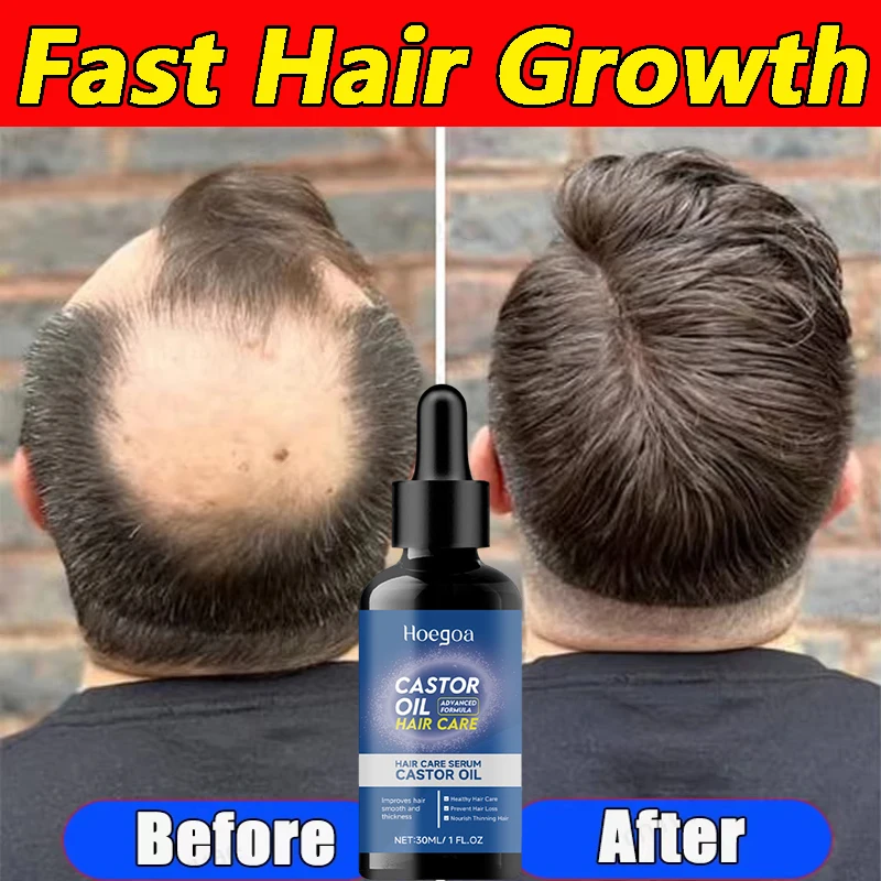 

Rapid Hair Growth Essence Reduces Hair Loss Improves Hair Texture Protects Hair Softens Hair Mildly Nourishes Scalp Hair Essence