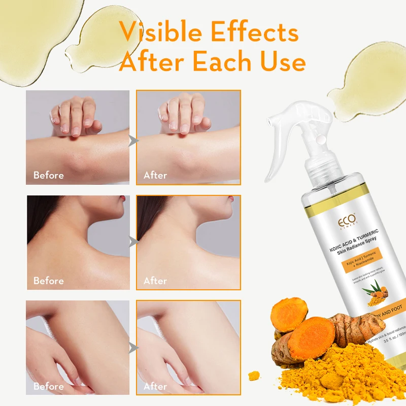 Kojic Acid & Turmeric Skin Brightening Spray for Body & Feet with Niacinamide - Radiance Enhancer Foot Care Solution