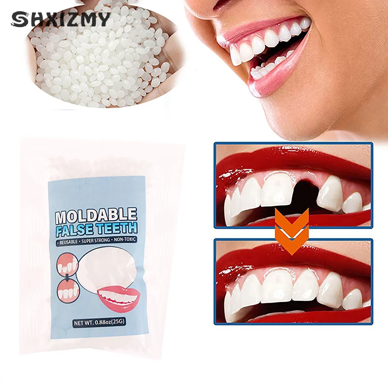 Resin 25g Temporary Tooth Repair Kit Teeth And Gaps False Teeth Solid Glue Denture Adhesive Teeth Whitening Tooth Beauty