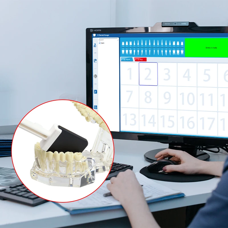 VV الأسنان 3 حجم كاشف الأشعة السينية الرقمية HD جهاز التصوير اتصال USB مريحة لعرض الصور مستشعر الأشعة السينية