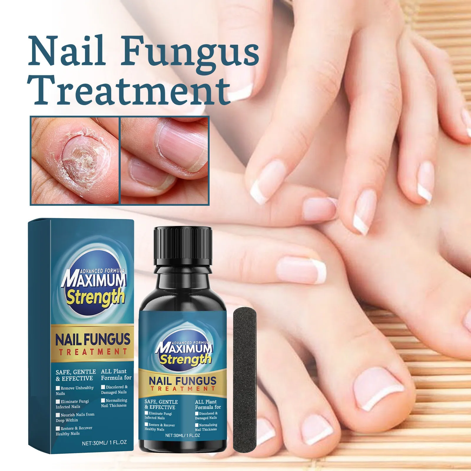 

Toenail Fungus Care Fastacting Nail Care Liquid For Fungus Under & Around Restores The Healthy Appearance Of Nails 30ml