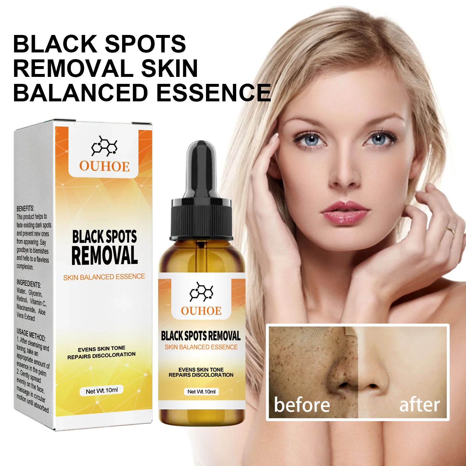 Anti-spot Remove freckles, chloasma, dark spots, hyperpigmentation, age spots, sun spots, whitening light spots