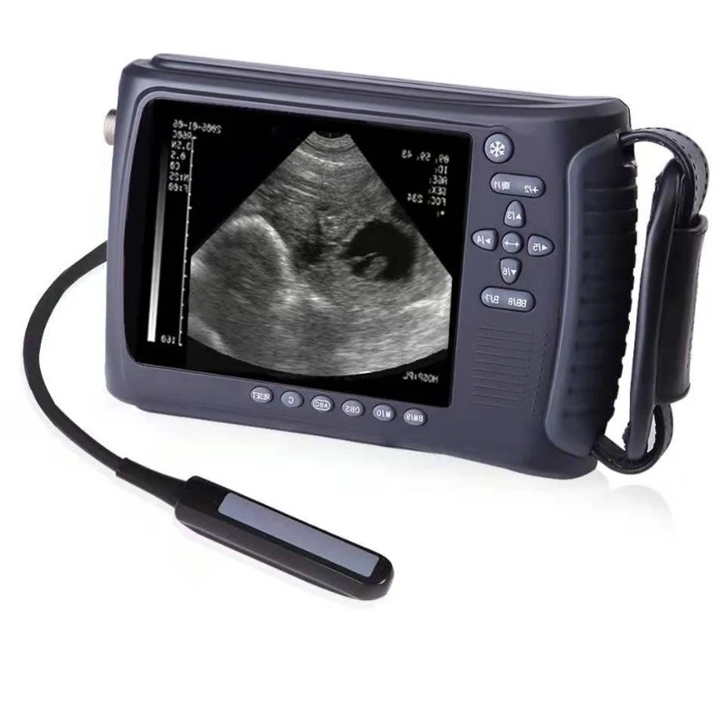 2026 Medical Supplier Hospital Equipment Ultrasound Scanner Handheld Ultrasound Machine for Pig Cattle Horse Goat Pregnancy
