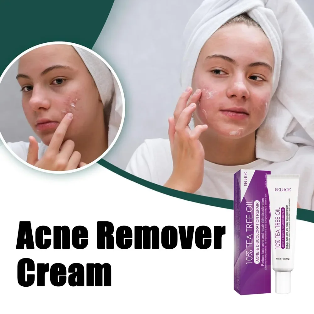 

Acne Clearing Cream for Face, Pimple Remover, Minimize Pores, Control Oil Skin Care