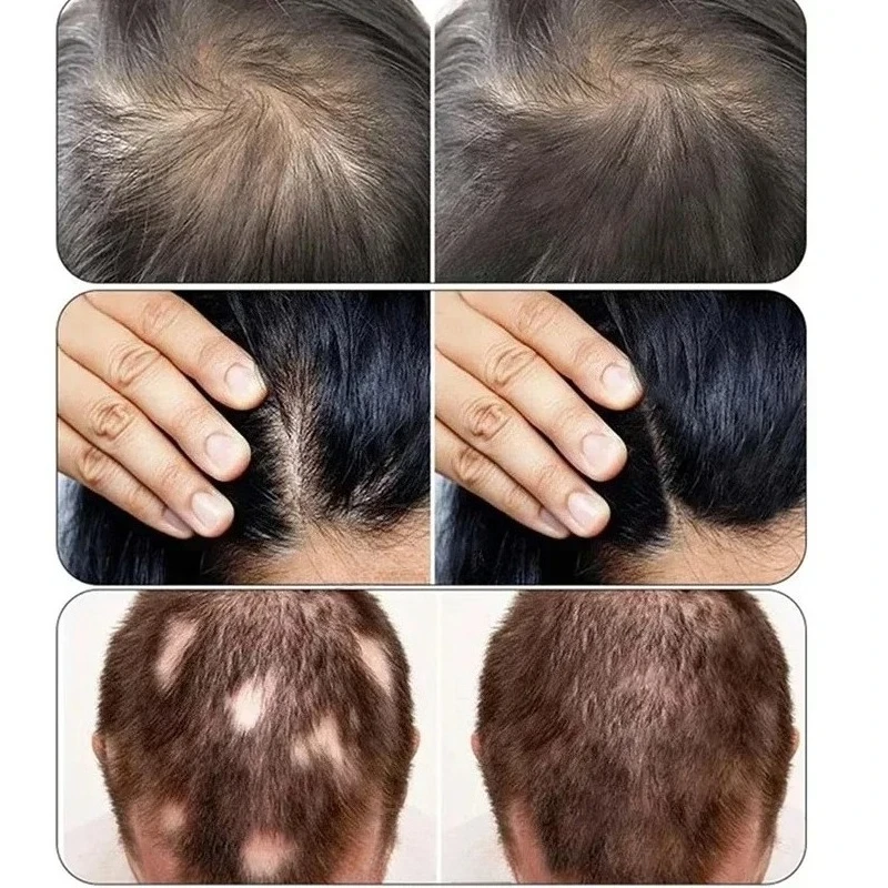 2025/5 in 1 SCALP DETECTOR WATER  SPRAY  SCALP MASSAGER   CURRENTCOMB BIO MERIDIAN BRUSH
