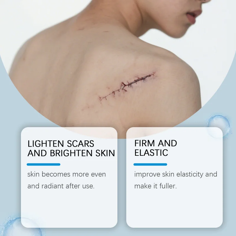 Combinazione quotidiana della pelle opaca: idrata, nutre, illumina il tono e riforner l'umidità