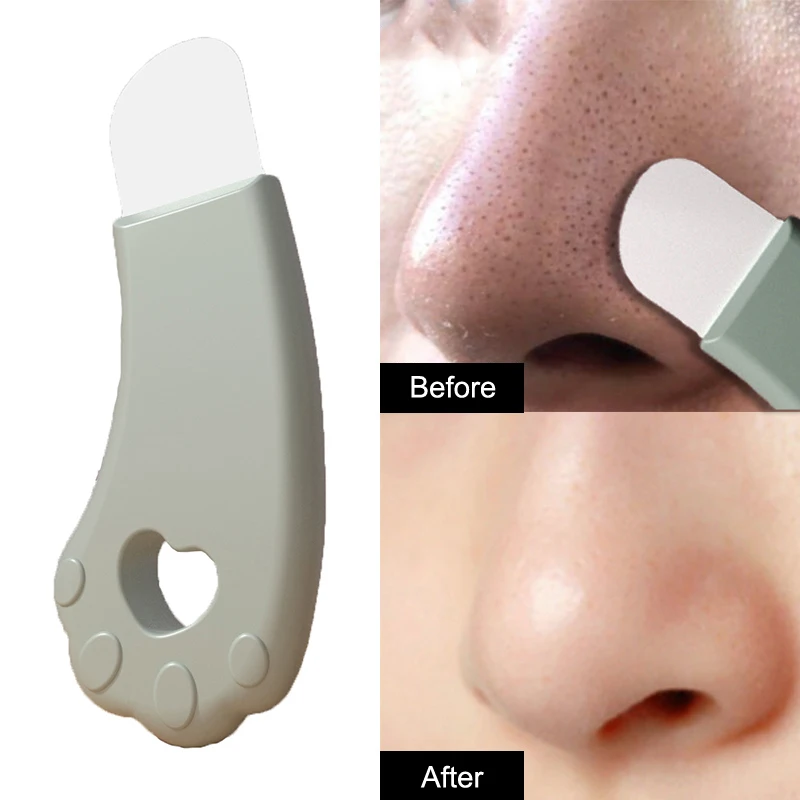 Épurateur de peau du visage spatule exfoliant outil de nettoyage en profondeur dissolvant de points noirs nettoyeur de pores spatule de peau du corps outil de soins de la peau