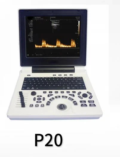 Portable PC Black and White Super P20 with Abdominal Convex Array Probe