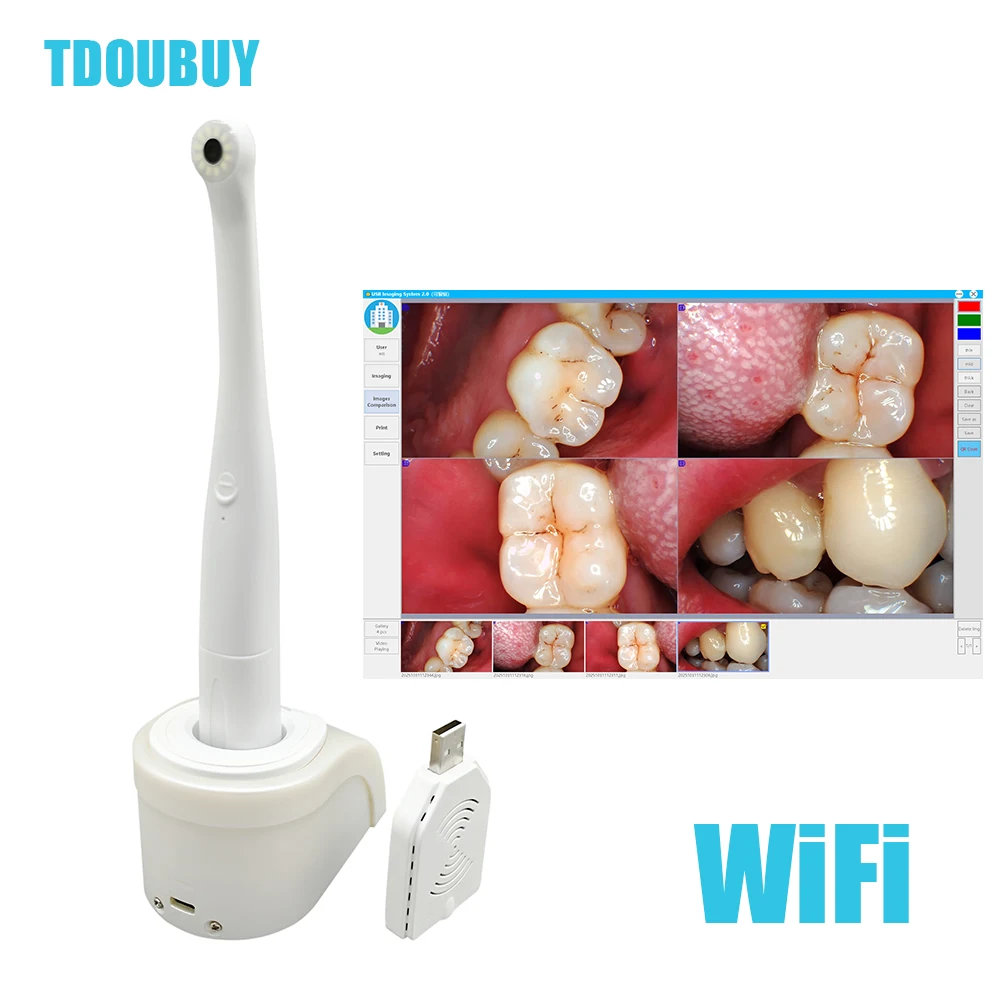TDOUBUY Denspay أحدث عدسة كاميرا لاسلكية واي فاي داخل الفم مع مستشعر صورة 1/4 CCD كاميرا محمولة داخل الفم للأسنان