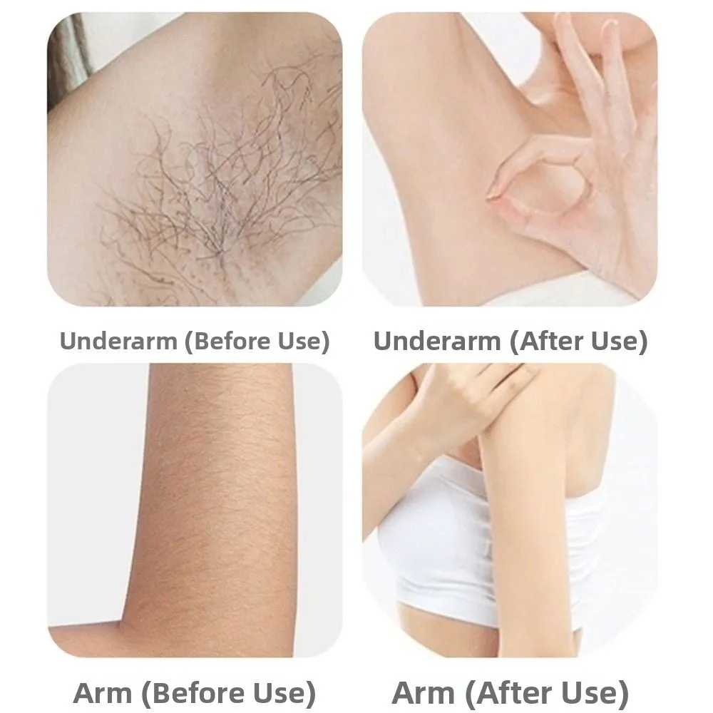 

Безболезненная машина для удаления волос, безопасная водонепроницаемая электробритва без черных пятен, портативная бритва для подмышек, частная зона