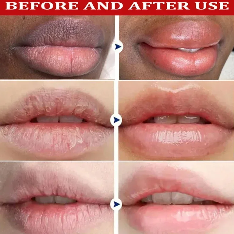 Penghilang Balsem Bibir gelap, masker Gloss pencerah Melanin, minyak pengelupas kulit bersih pelembab produk perawatan Korea Perawatan Kecantikan Kesehatan