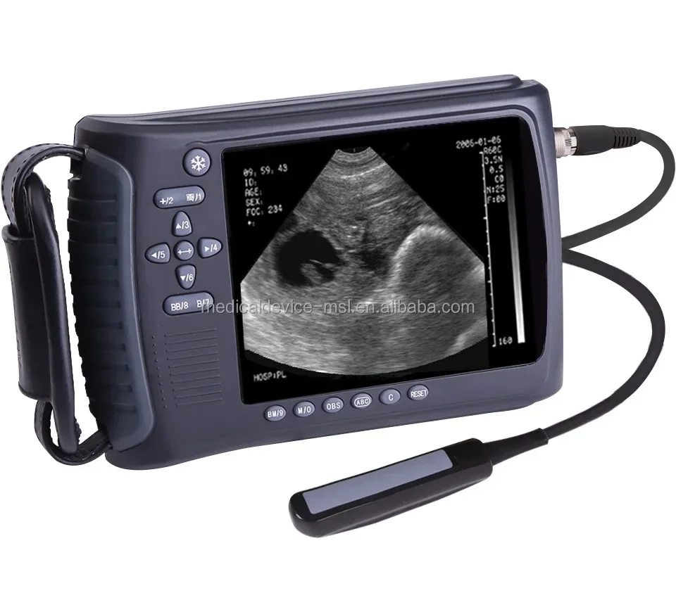 Sector ultrasonic diagnostic instrument handhold sheep/dogs/cats veterinary  machine