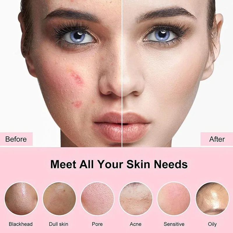Sonic vibrierende Silikon-Gesichtsreinigungsbürste, wasserdichte Peeling-Gesichtsbürste, Beauty-Tool