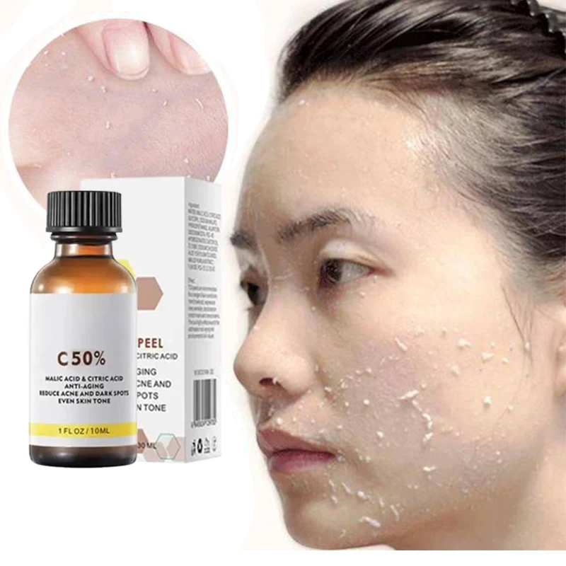 3nd Peeling Oil for Dark Skin Spots, Remove Dead Skin, Lighten Melanin Scrub, Exfoliating, Brighten Moisturize, Facial Skin Care