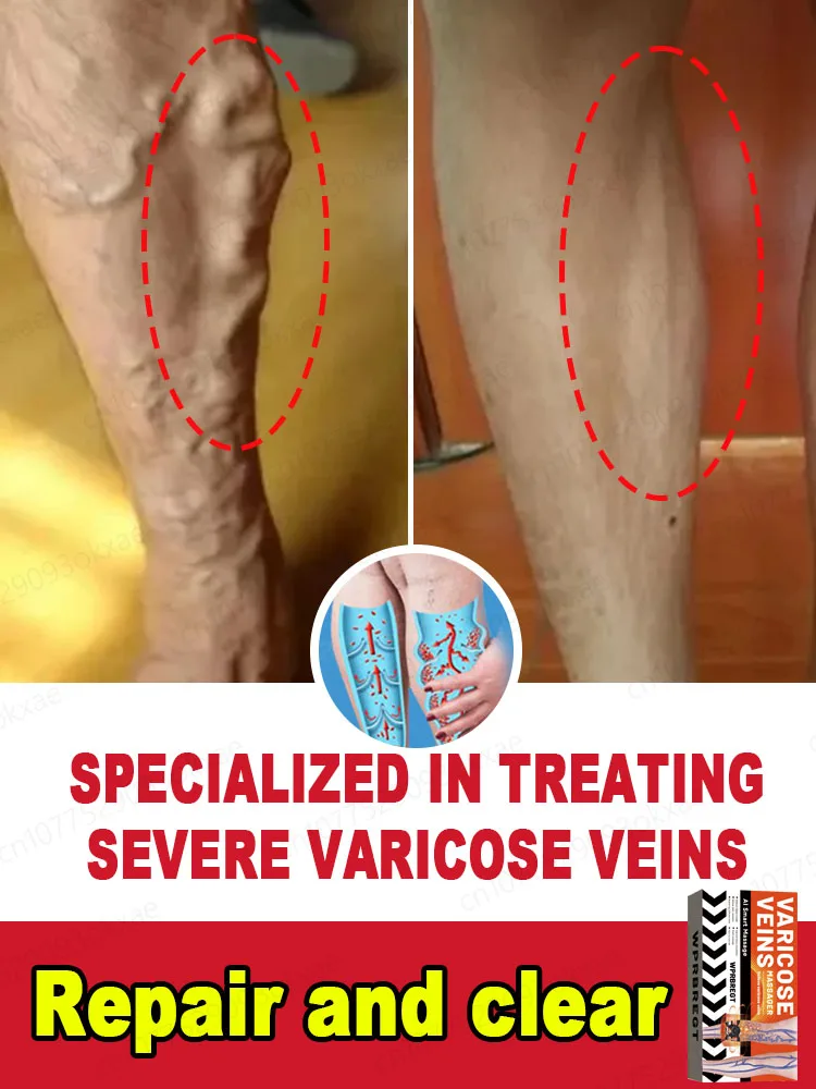 

Foot care to get your legs back to normal