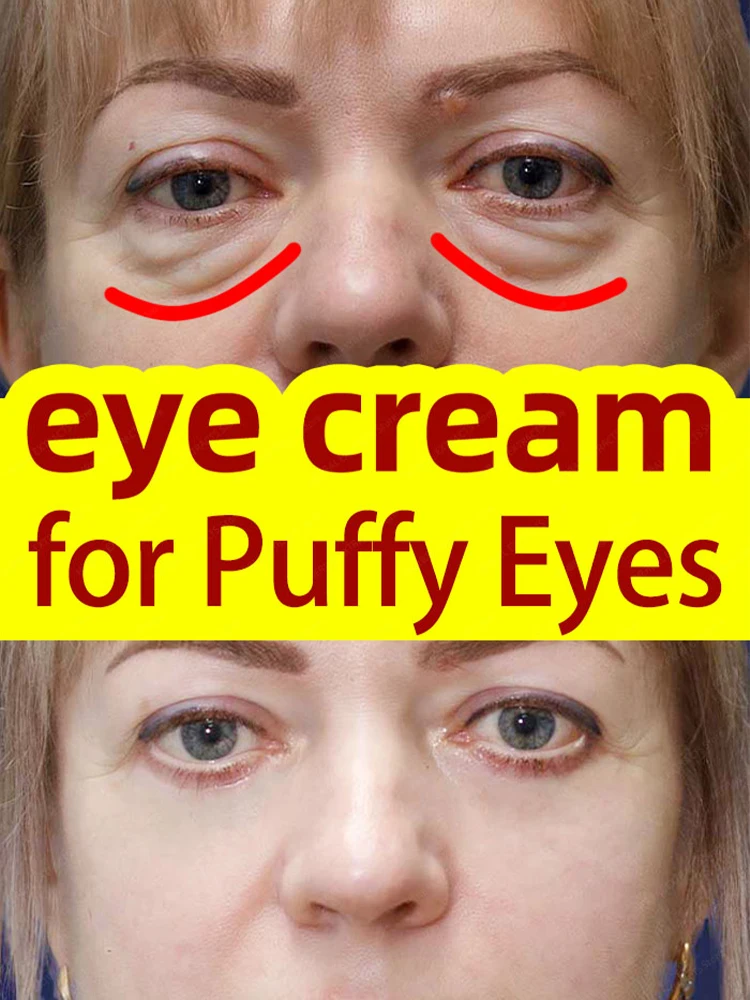 

Firms and lightens dark circles