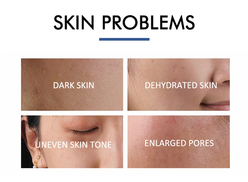 10 % Niacinamid-Essenz, Private Label, veganes B5, feuchtigkeitsspendendes Hyaluronsäure-Serum für das Gesicht, individuelles Logo, Mekeup, Bulk, tierversuchsfrei