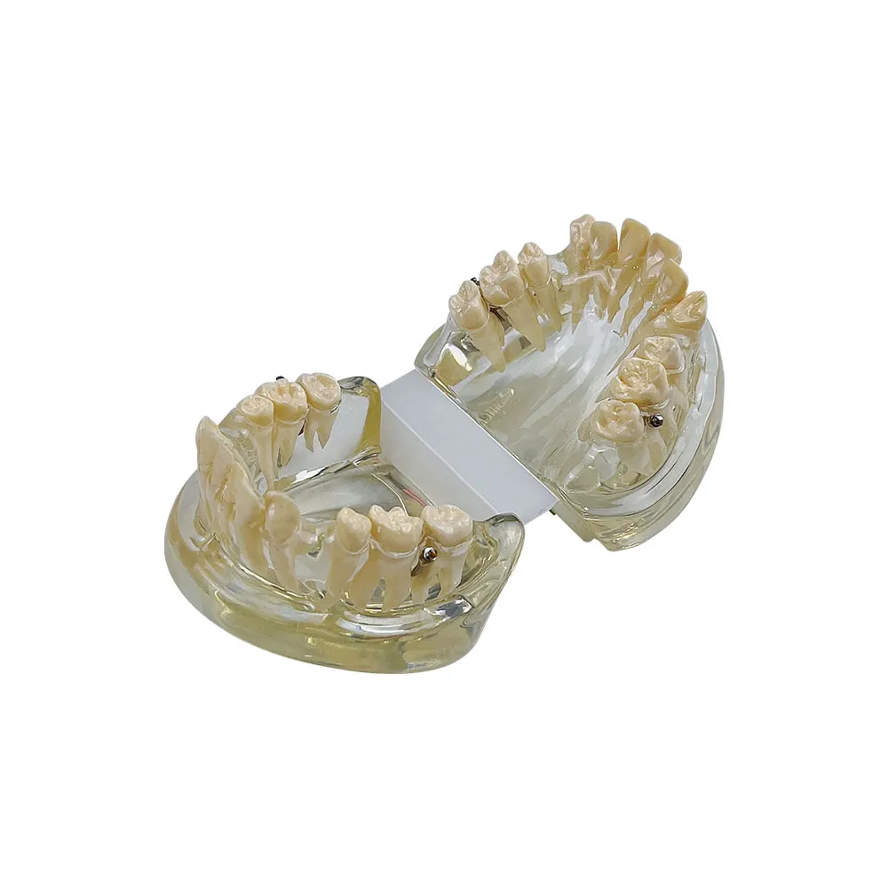 

Orthodontic Treatment Teeth Model Resin Study Model Malocclusion Correction Typodont Model For Studying Dentist Communication