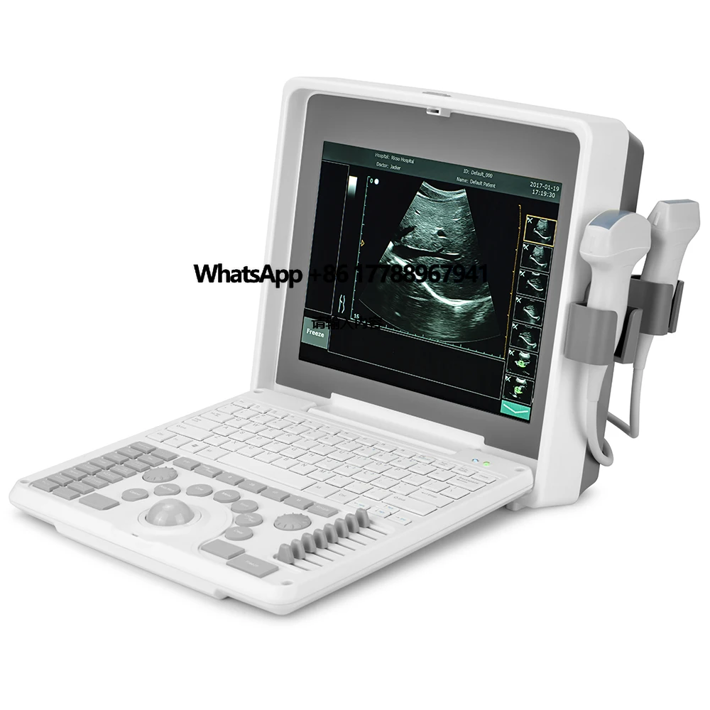 

Hospital Diagnostic Equipment Laptop Escaner Ultrasonido Medical Veterinary Portable B Ultrasound Machine