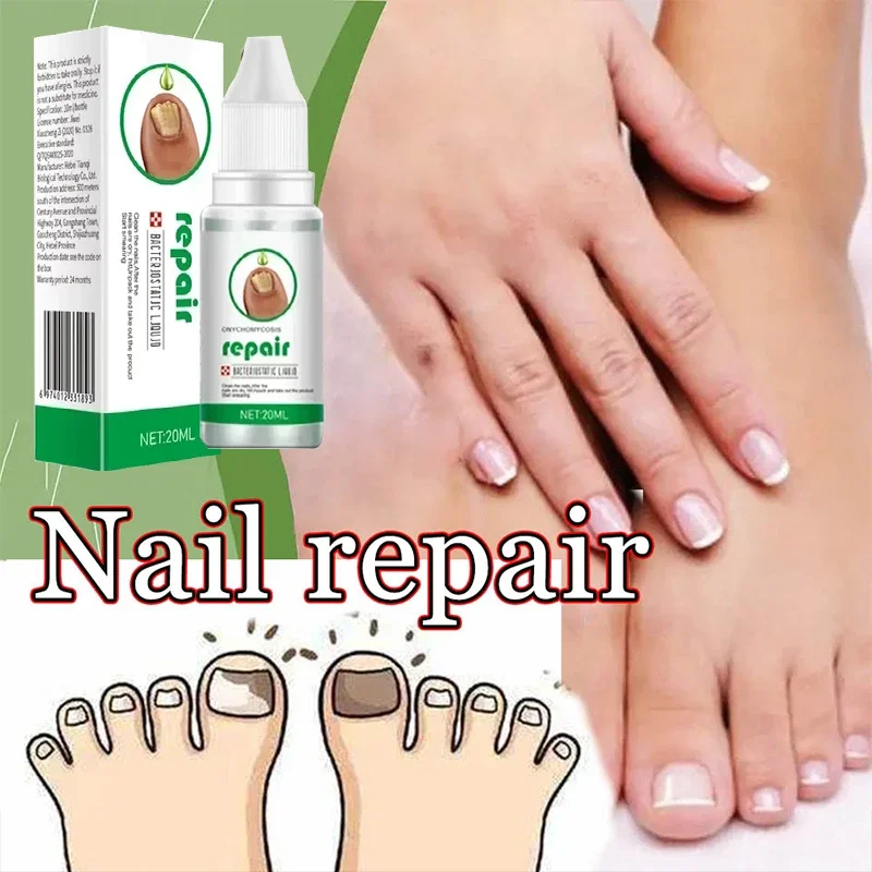 Strong Nail Fungus Treatment Serum Essence oil Feet Nails Repair Care Essence Cream Anti Infection Toe Fungal Removal