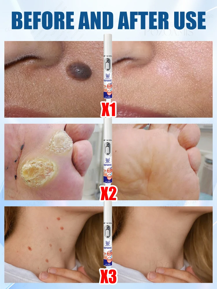 ᔆᴋɪɴ ᴍᴀɴᴀɢᴇᴍᴇɴᴛ ᴍᴀᴋᴇs ʏᴏᴜ ʟɪᴠᴇ ᴡɪᴛʜ ᴄᴏɴғɪᴅᴇɴᴄᴇ 問題を解決する