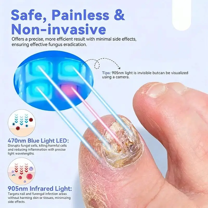

[WHB]Nail Fungus Laser Device Repair Digital Display Nails Fungus Laser Assist Tool Toenails Repair