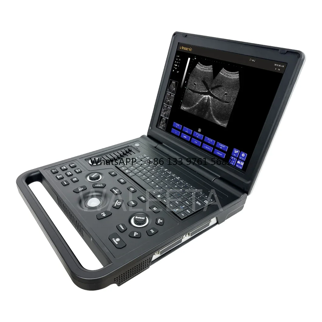 Best price Hospital Medical echographe portable white and black ultrasound for manufacture sale