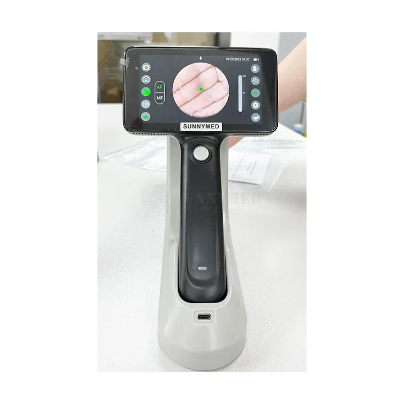 SY-V042A Portable Ophthalmology Handheld Fundus  Retina   Price