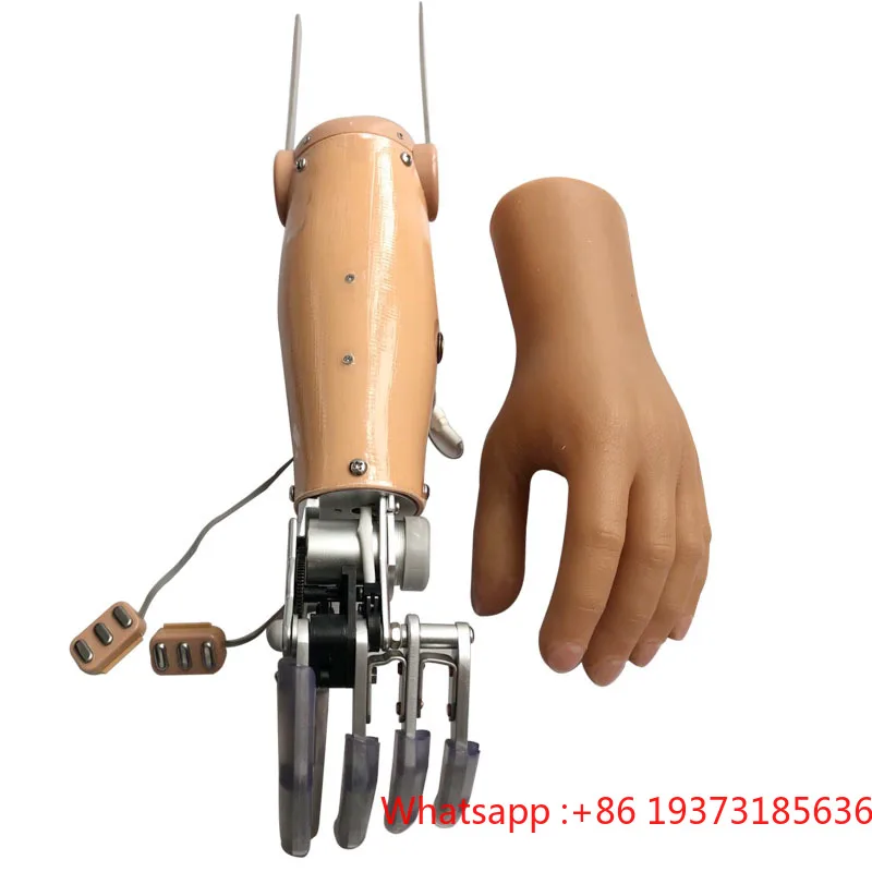 Medical Implants Prosthetic Limbs Myoelectric Control Elbow With Two Degrees Of Freedom For Hand Prosthesis