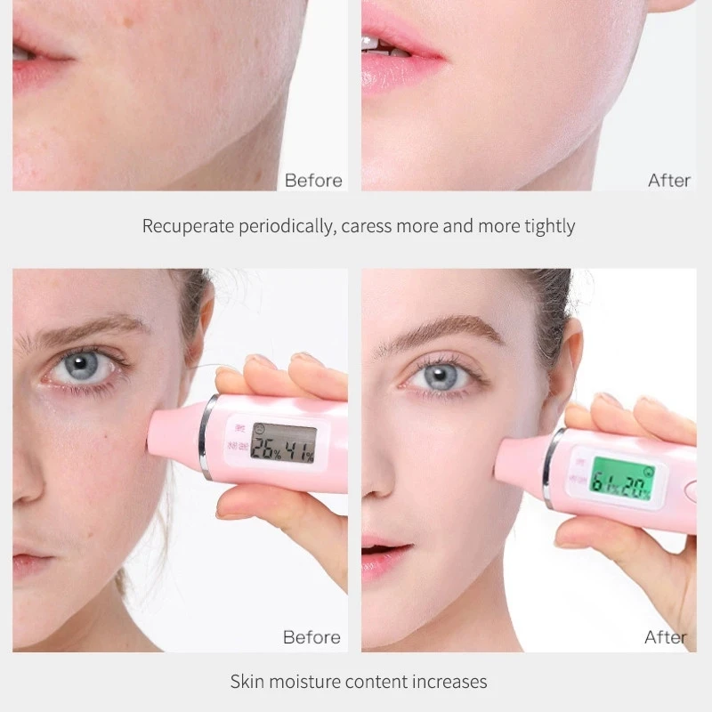 VENZEN Rejuvenating Face Cream With Niacinamide Vitamin E Deep Moisturizing Nutrition Whitening Anti-aging Face Skin Care 50g view 5