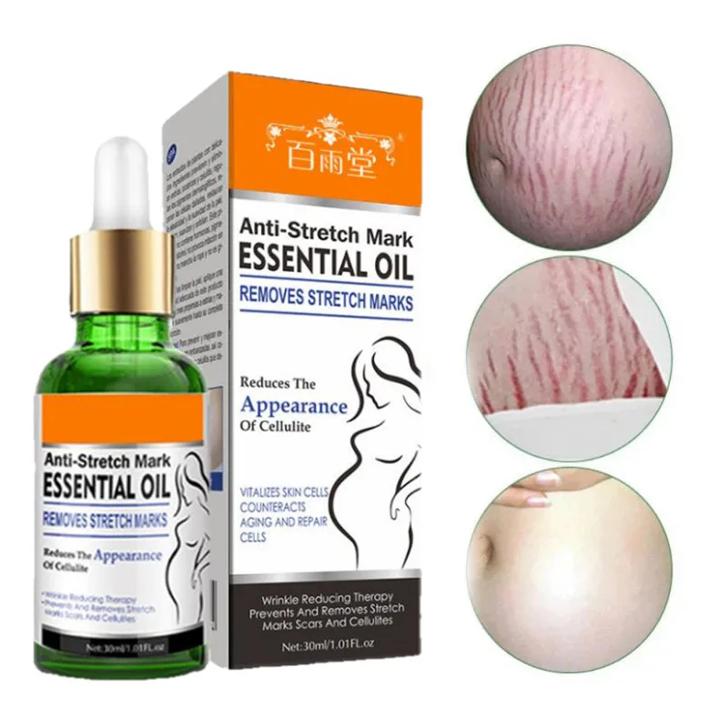 Huile essentielle démaquillante pour femme enceinte, crème de traitement pour soins de la peau, pour éliminer les marques commandées, ALTERSlackline