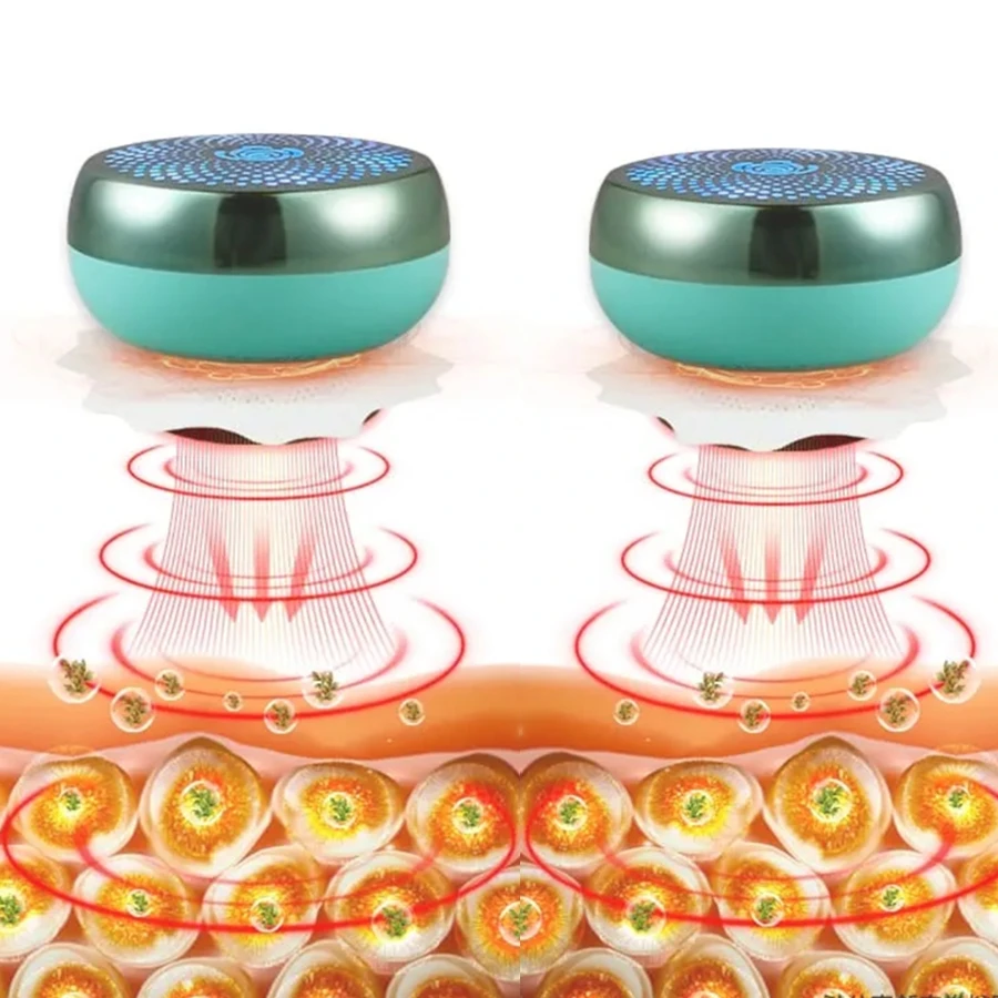 Customizable Electric Moxa Box Smokeless Portable Moxibustion Apparatus Neck Shoulder Heated MoxaTherapy for Home