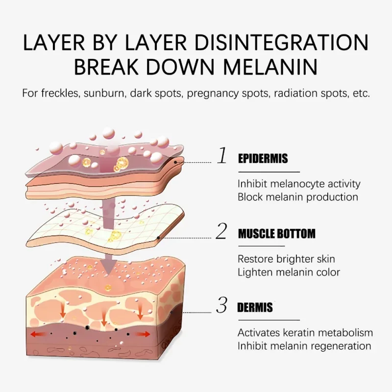 Sbiancare la crema lentiggine illuminare efficace migliorare l'ottusità rimuovere le macchie scure Melasma dissolvenza melanina Anti-pigmentazione cura della pelle del viso