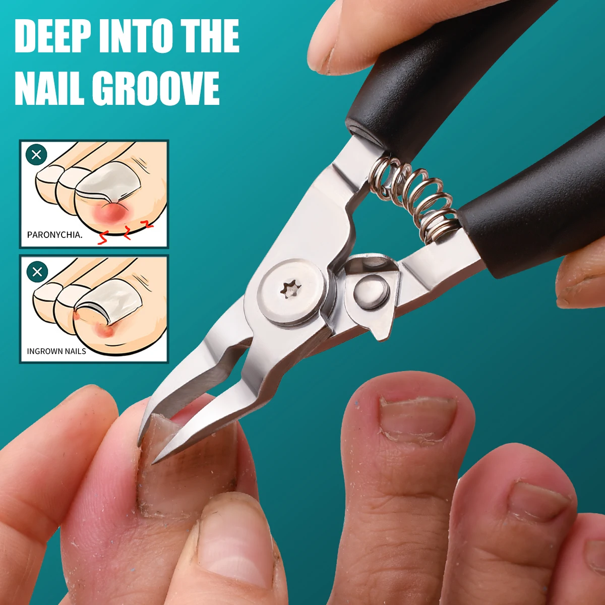 Professional nail clippers, nail groove trimmers for correcting inward growth of rough nails, nail clippers or foot repair tools