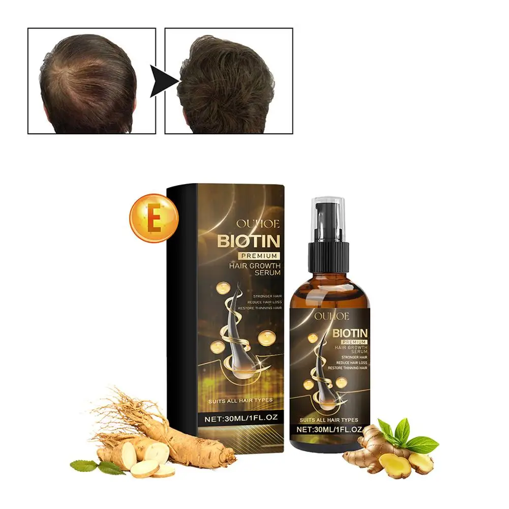 Prodotti di biotina da 30ml olio essenziale per capelli a crescita rapida cura dei capelli previene la caduta dei capelli trattamento del cuoio capelluto per uomo donna M0Y3