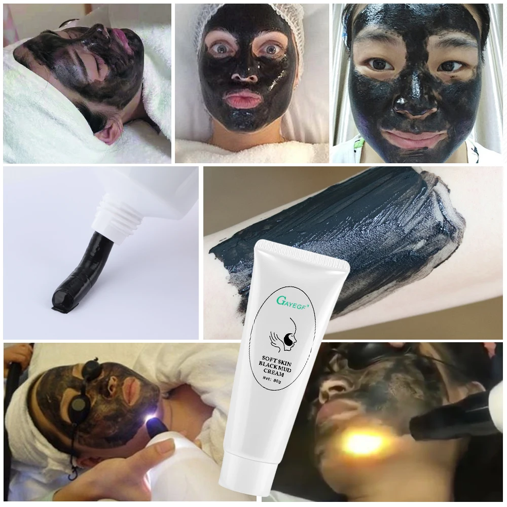 Neue Carbon Gel Tiefen Reinigung Feuchtigkeitsspendende Schwarze Gesichtscreme Für Laser Haut Verjüngung Entfernung Mitesser Bleaching Hautpflege
