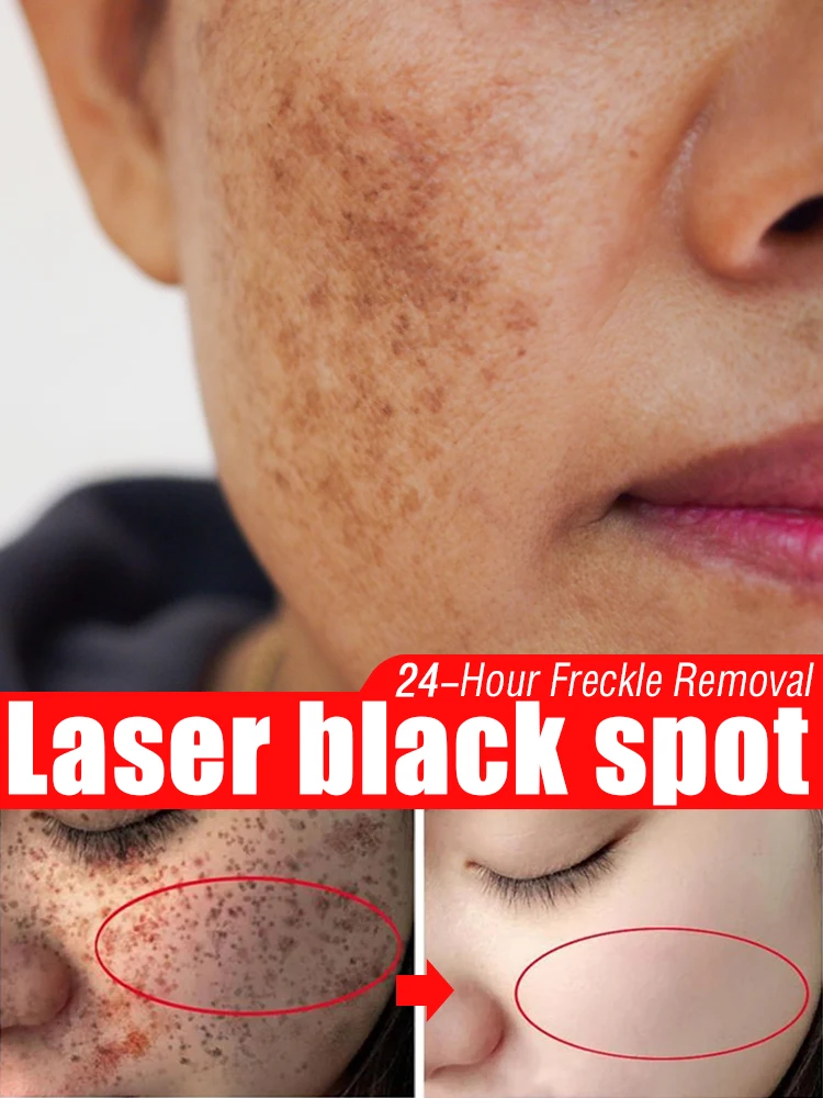 

Laser to Restore your beautiful appearance