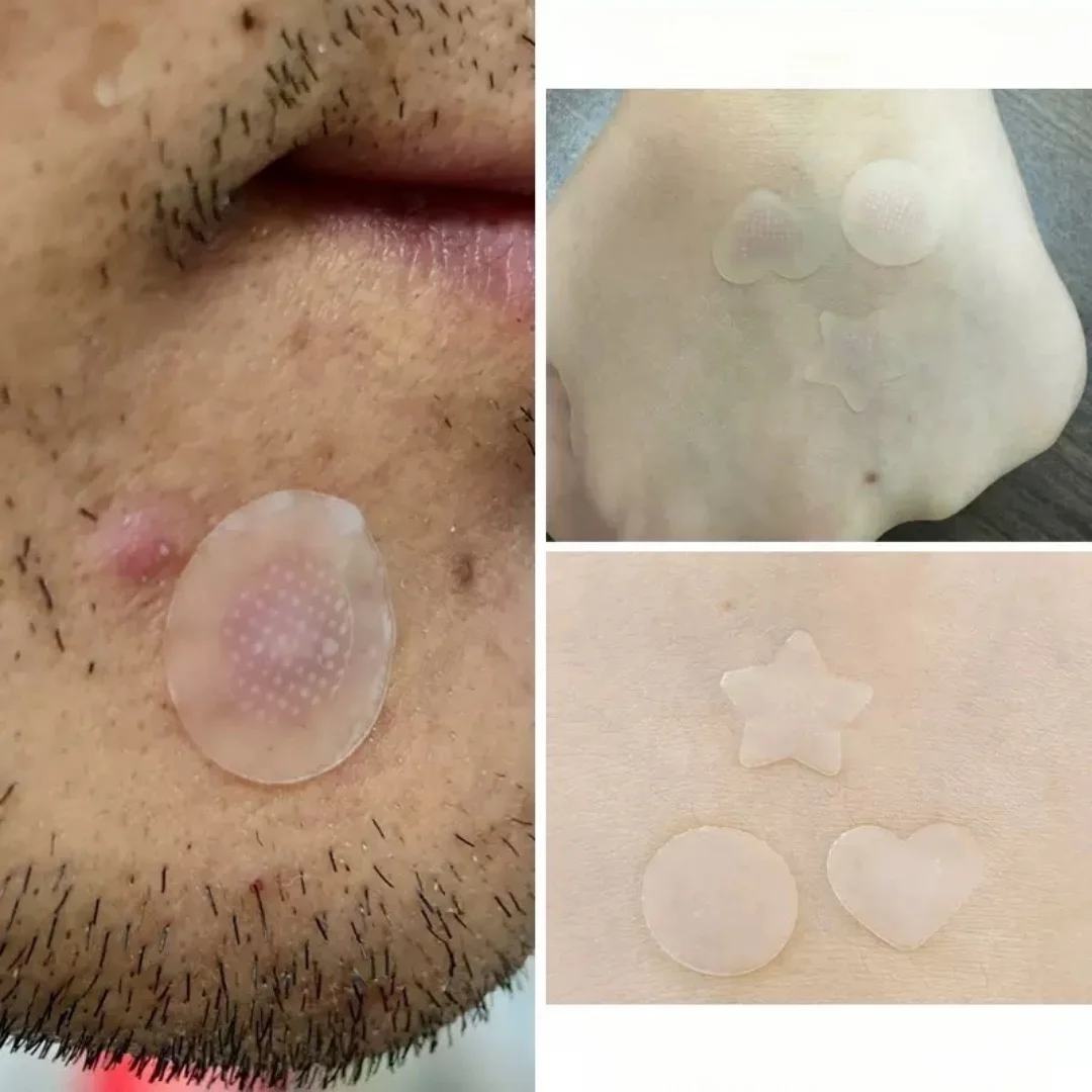 9 قطع من رقعة حب الشباب على شكل قلب لطيف: غرواني مائي من الدرجة الطبية، آمنة للبشرة الحساسة للتطبيق بثقة