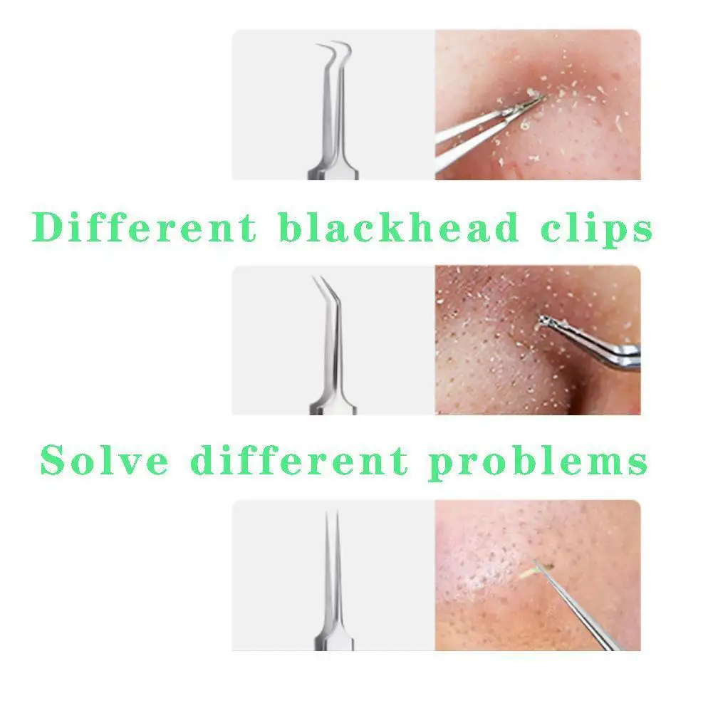 Ultrafijne Celpuistjes Mee-Eter Clip Pincet Schoonheidssalon Speciaal Schrapen En Sluiten Artefact Acne Naald Gereedschap Acne Clip