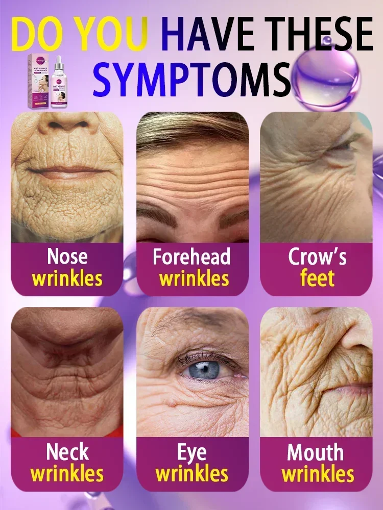 Immersive anti-wrinkle! It turns out that you can become younger and more beautiful in this way