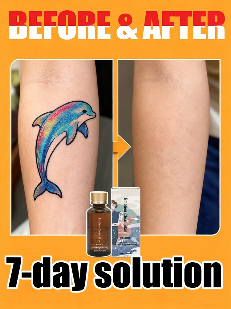 

Quick Tattoo Removal Serum in 7 Days
