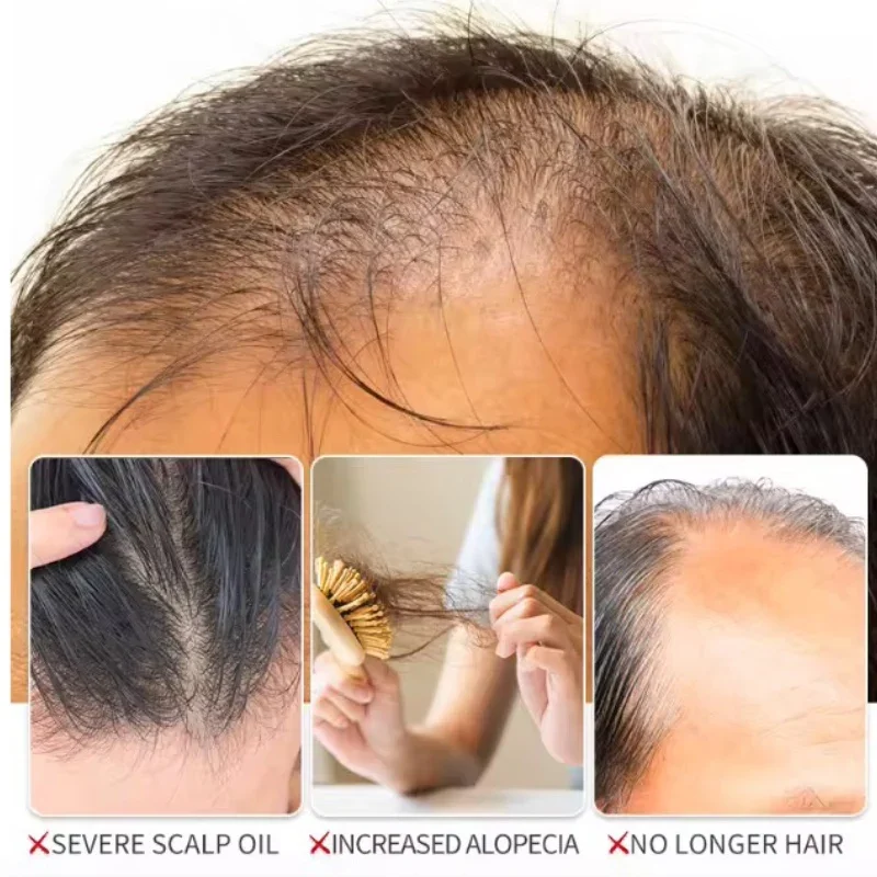 تعزيز حيوية الشعر! بخاخ زيت العناية بالشعر العضوي من إف إي جي 50 مل لامع