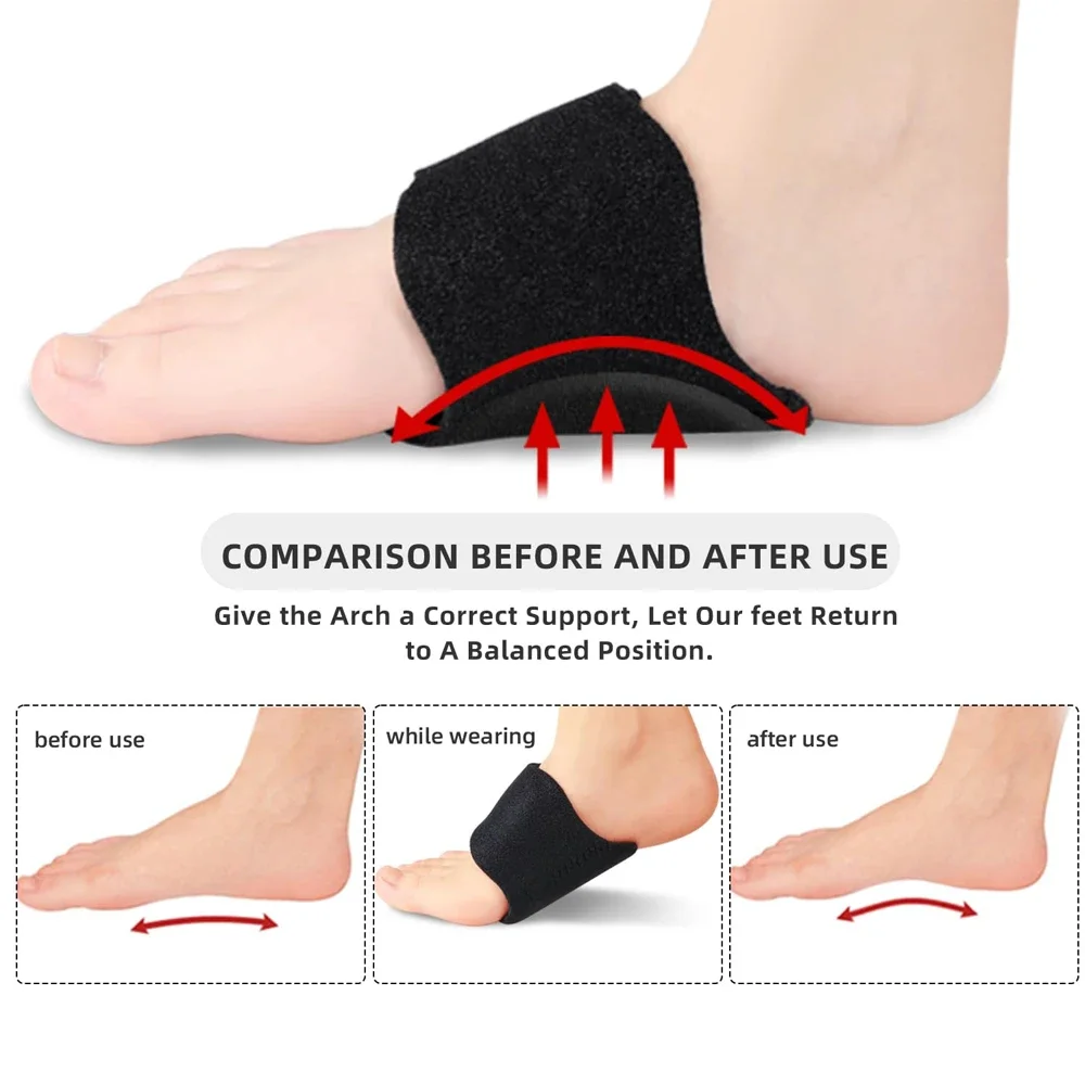 1 Pair Arch Support, Adjustable Orthotics Compression Arch Support Braces Bands, Gel Pads for Flat Feet High & Fallen Arches