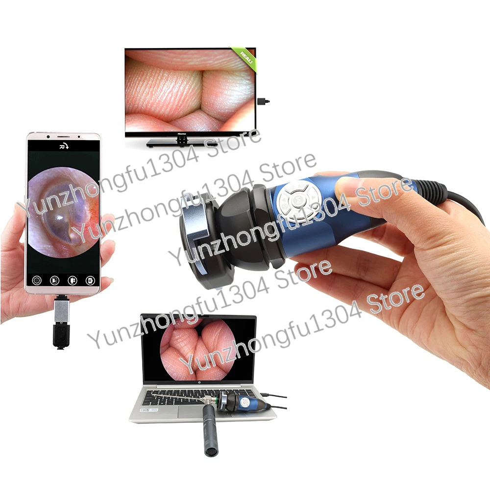 Full HD Endoscope Camera 1080P Portable Endoscope