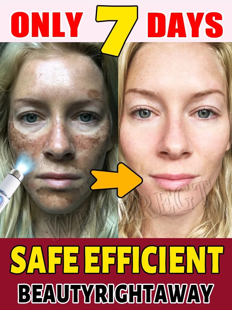 Handheld Home Facial Care Device At-Home Beauty Treatment for Spot Removal Blemish Eliminator Youthful Complexion Promoter